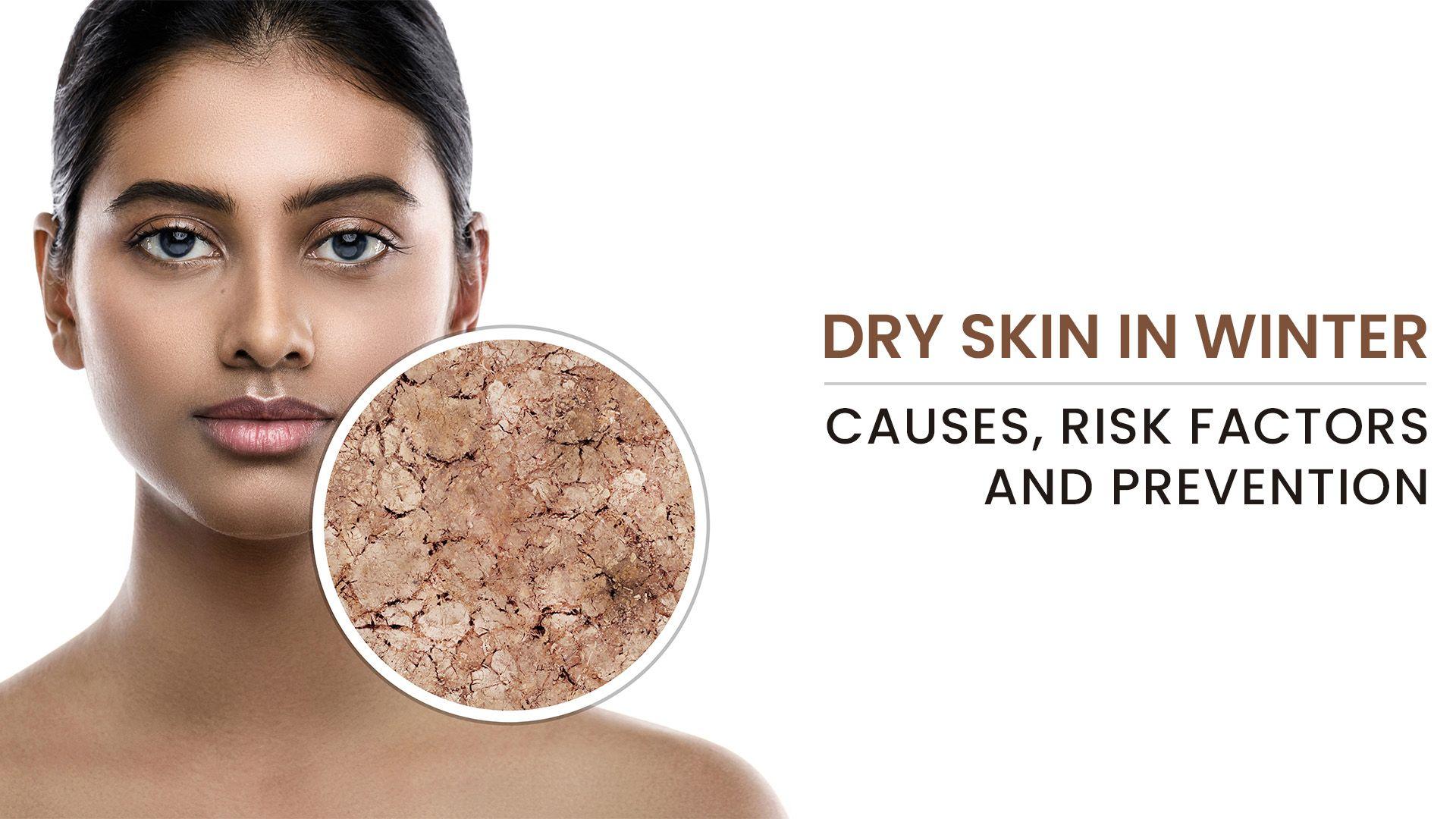 Beat Dry Skin in Winter: Causes, Symptoms, Prevention & Effective ...