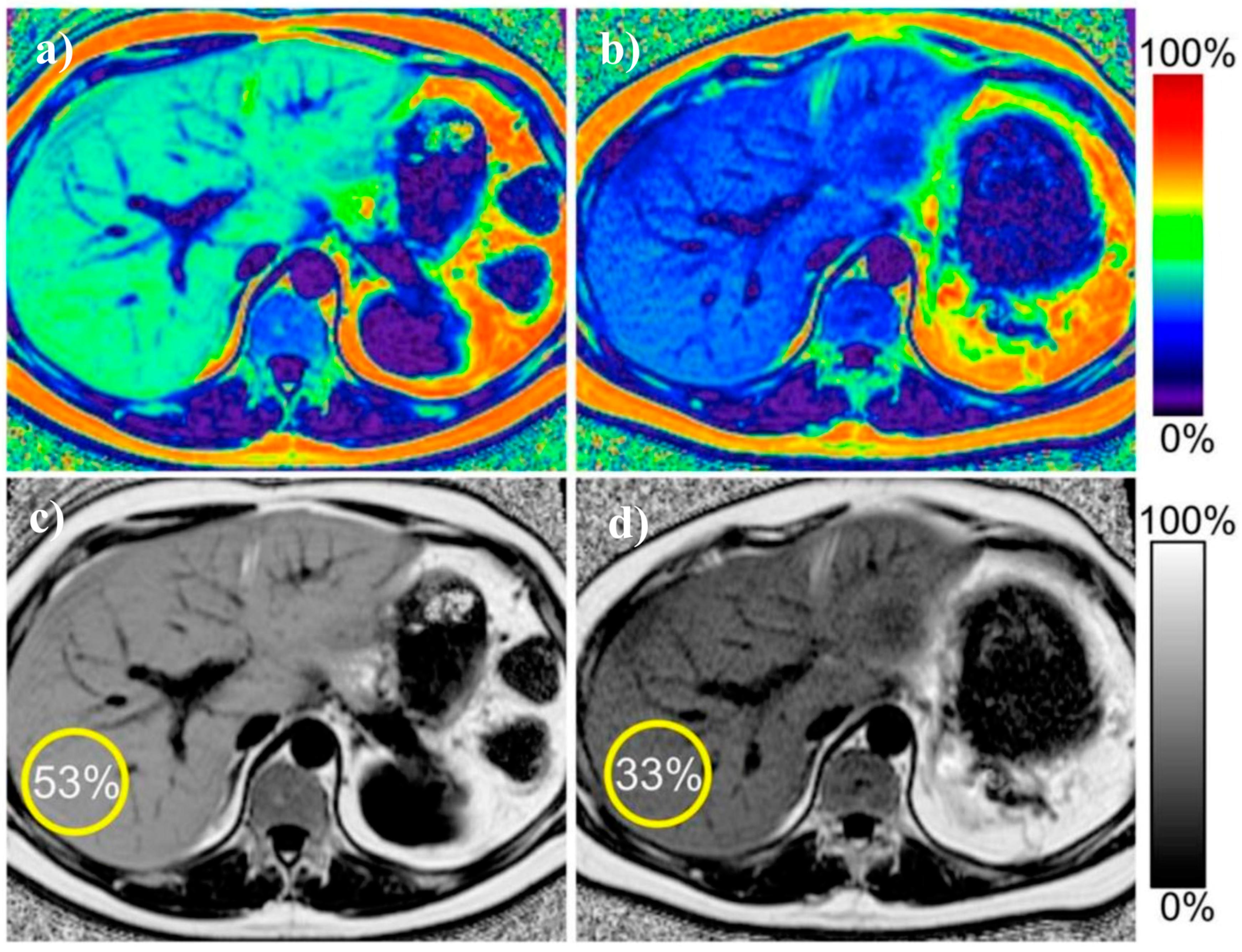 Biomedicines | Free Full-Text | Usefulness of Different Imaging ...